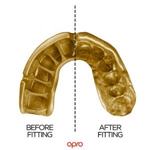 OPRO Gold Competition Level Adult and Youth Sports Mouthguard with Case, Gum Shield for Rugby, Hockey, Lacrosse, Boxing, MMA and Other Contact and Combat Sports (Youth, Black/Gold)