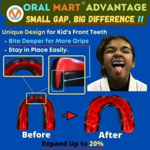 Oral Mart Youth Mouthguard for Kids (Black/Yellow) - Youth Mouthguard for Karate, Flag Football, Martial Arts, Taekwondo, Boxing, Football, Rugby, BJJ, Muay Thai, Soccer, Hockey (with Free Case)